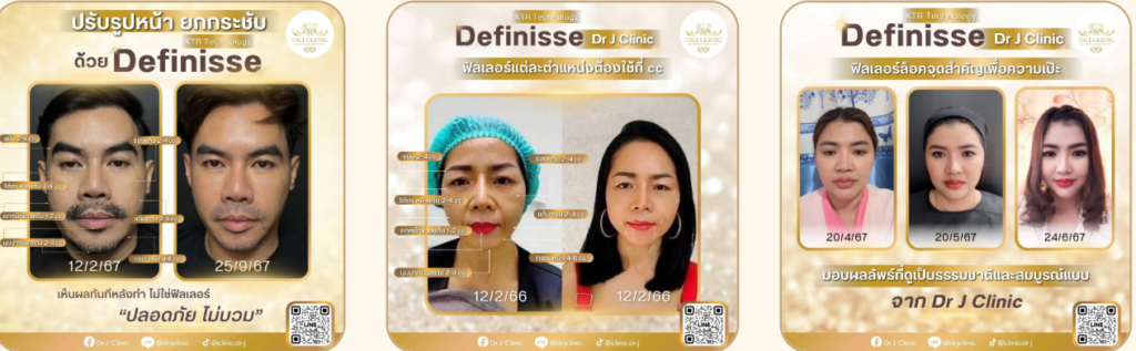 คลินิกปรับรูปหน้า กรุงเทพ